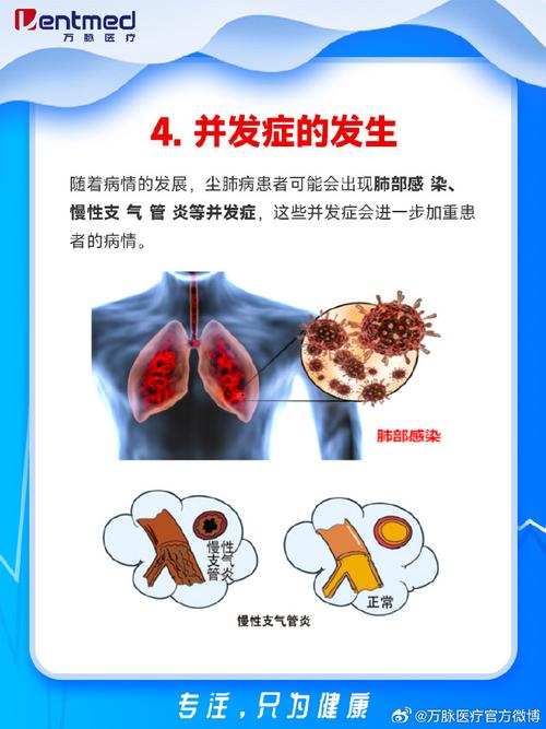 戴口罩导致肺结节？残留的环氧乙烷会致癌？真相来了